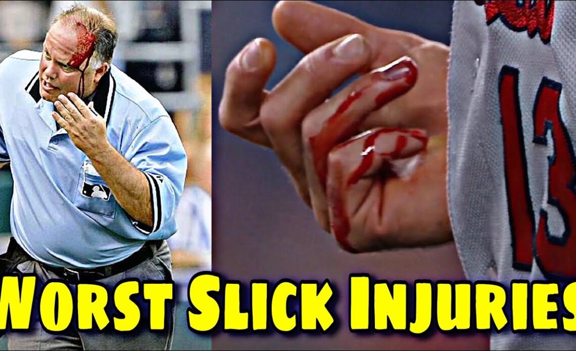 Most Painful Injuries in Baseball History