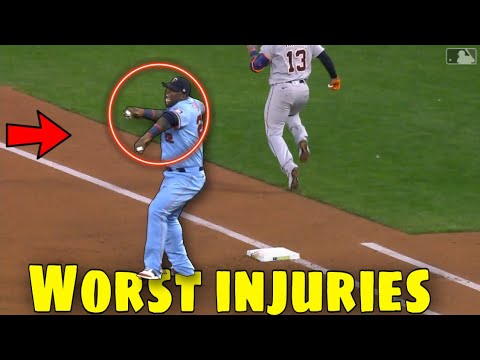 MLB | Worst Baseball Injuries